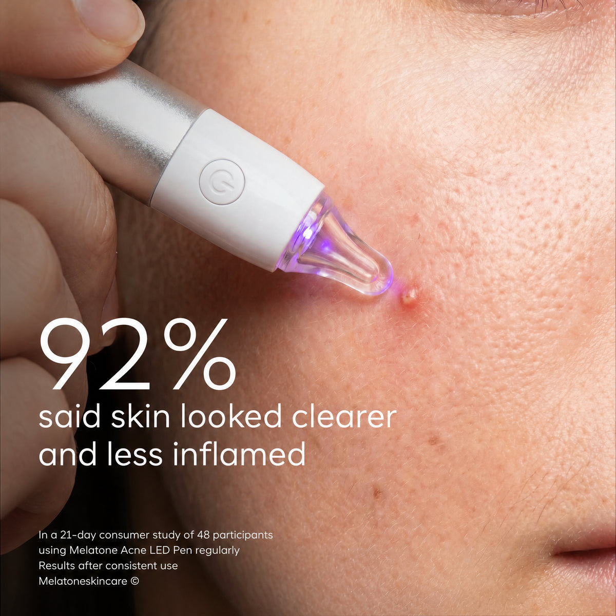 Melatone Acne Repair LED Pen